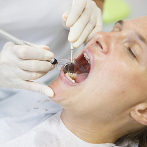 Flap Surgery in Guntur