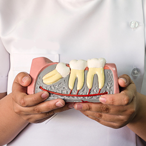 Dental Impaction in Guntur